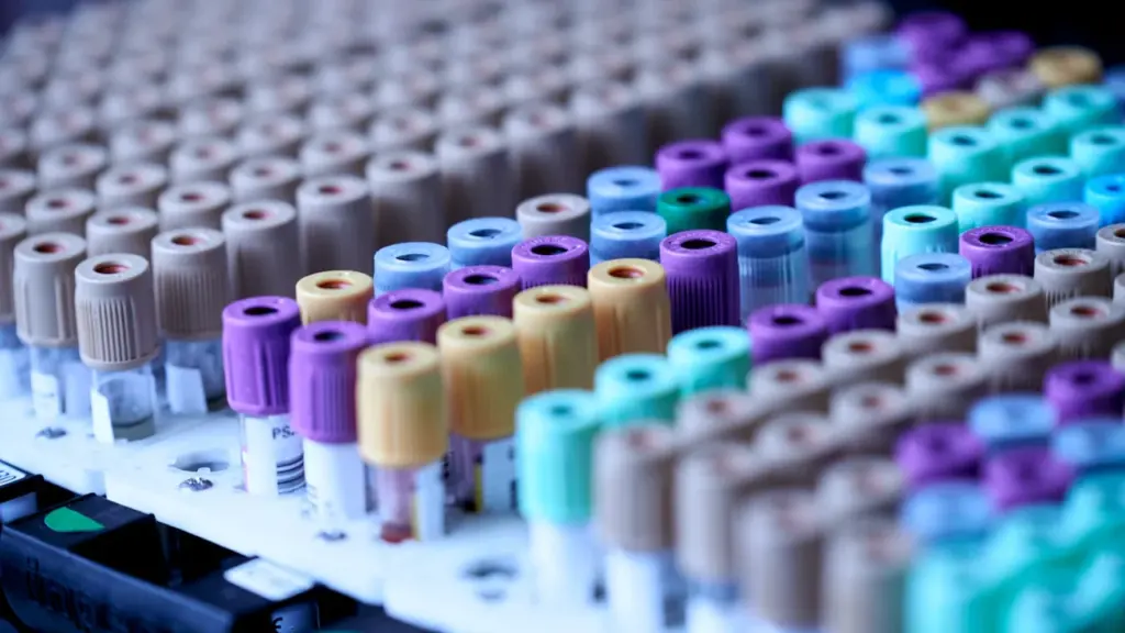 Laboratoriniai kraujo mėgintuvėliai su spalvotais kamšteliais paruošti atlikti medicininius tyrimus.